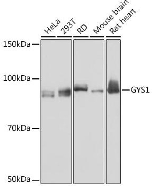 Metabolism Antibodies 3 Anti-GYS1 Antibody CAB8912