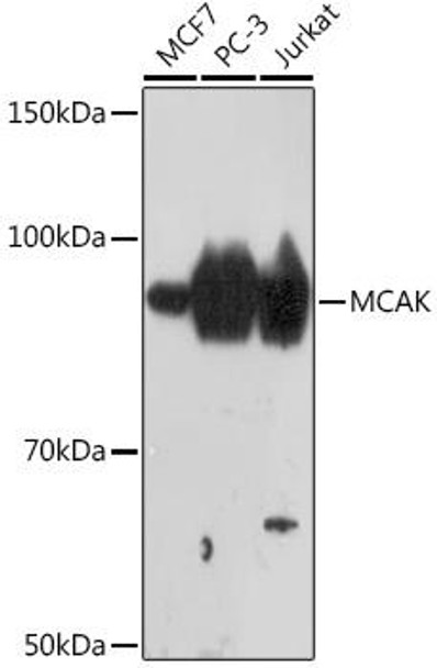 Cell Cycle Antibodies 2 Anti-MCAK Antibody CAB9140