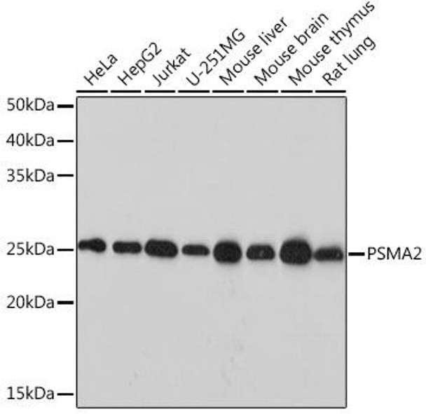 Cell Biology Antibodies 17 Anti-PSMA2 Antibody CAB9182