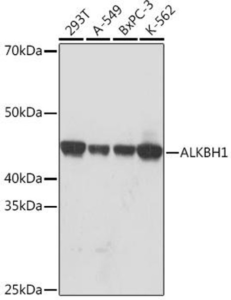 Epigenetics and Nuclear Signaling Antibodies 5 Anti-ALKBH1 Antibody CAB9221