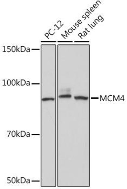 Cell Cycle Antibodies 2 Anti-MCM4 Antibody CAB9251
