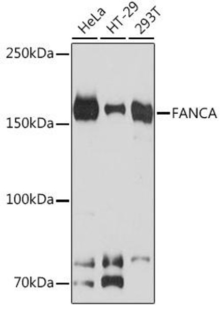 Epigenetics and Nuclear Signaling Antibodies 5 Anti-FANCA Antibody CAB9529