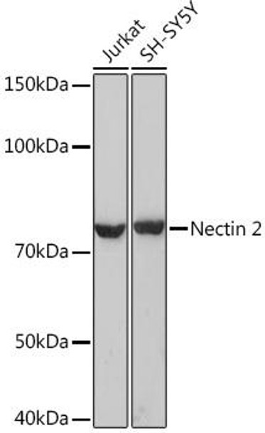 Cell Biology Antibodies 17 Anti-Nectin 2/CD112 Antibody CAB9622