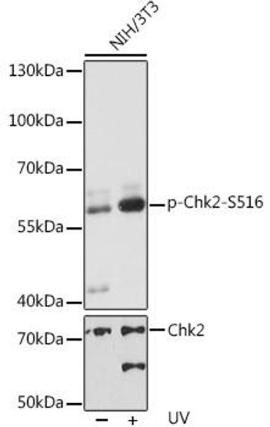 Cell Death Antibodies 2 Anti-Phospho-Chk2-S516 Antibody CABP0604