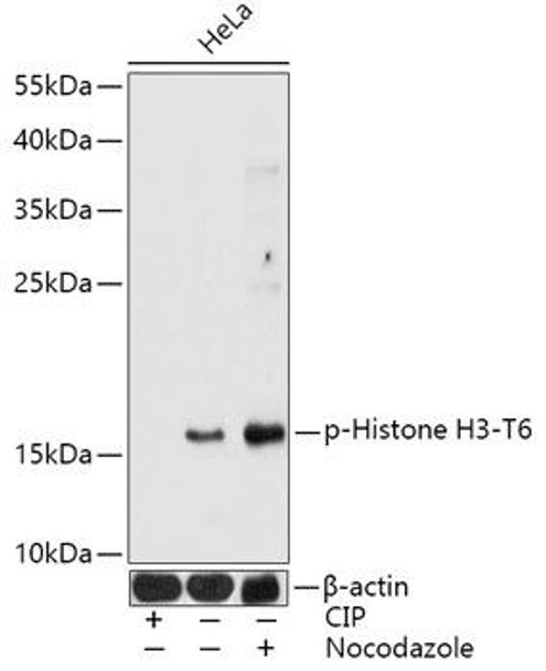 Epigenetics and Nuclear Signaling Antibodies 5 Anti-Phospho-Histone H3-T6 Antibody CABP0899