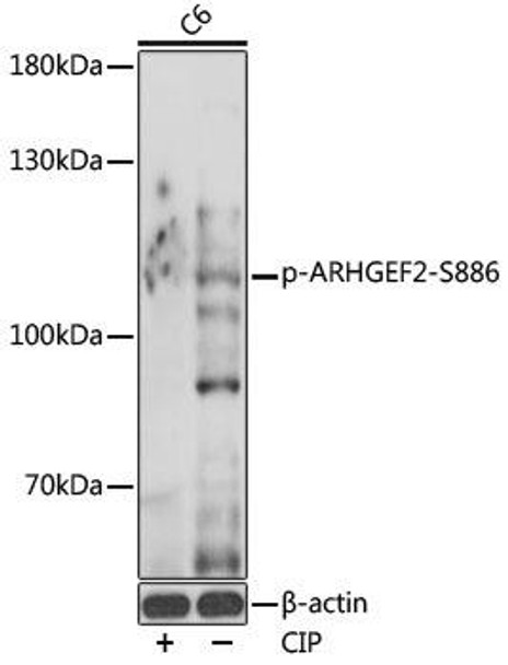 Cell Cycle Antibodies 2 Anti-Phospho-ARHGEF2-S886 Antibody CABP0926