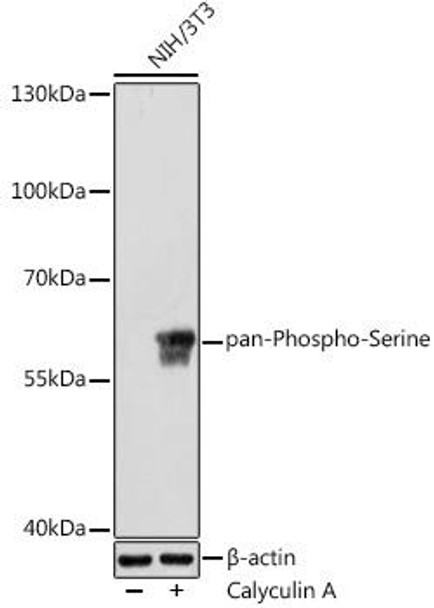 Cell Biology Antibodies 15 Anti-pan-Phospho-Serine Antibody CABP0932