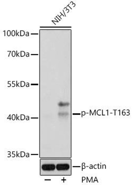 Cell Death Antibodies 2 Anti-Phospho-MCL1-T163 Antibody CABP0943