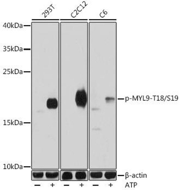 Cell Biology Antibodies 14 Anti-Phospho-MYL9-T18/S19 Antibody CABP0955