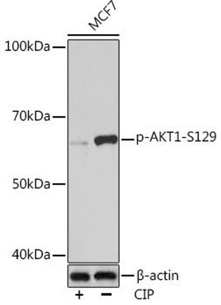 Cell Death Antibodies 2 Anti-Phospho-AKT1-S129 Antibody CABP0981