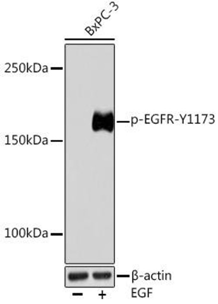 Immunology Antibodies 3 Anti-Phospho-EGFR-Y1173 Antibody CABP0992