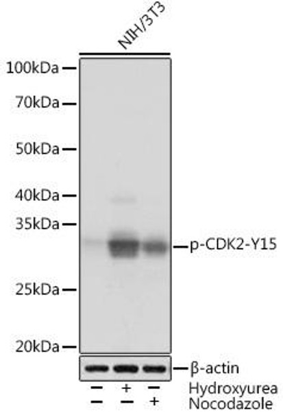 Cell Cycle Antibodies 2 Anti-Phospho-CDK2-Y15 Antibody CABP1005