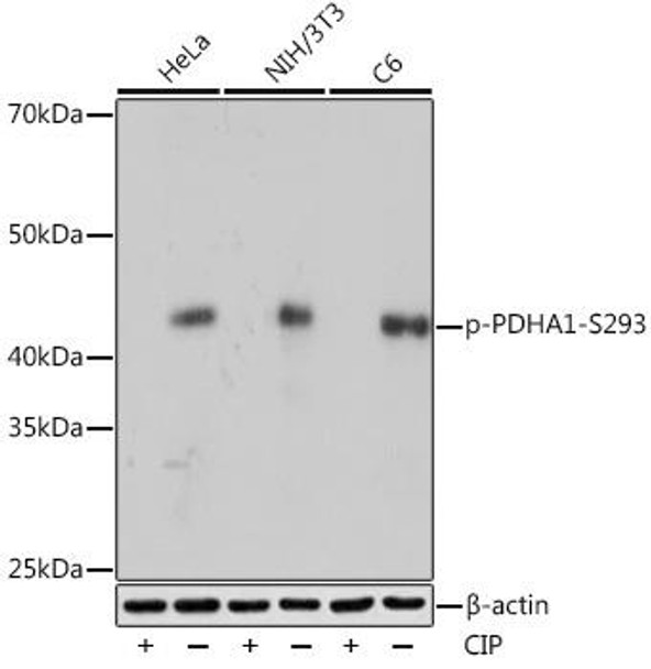 Metabolism Antibodies 3 Anti-Phospho-PDHA1-S293 Antibody CABP1022