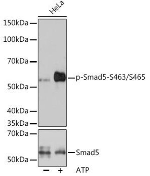 Epigenetics and Nuclear Signaling Antibodies 5 Anti-Phospho-Smad5-S463/S465 Antibody CABP1023