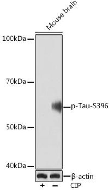 Cell Biology Antibodies 14 Anti-Phospho-Tau-S396 Antibody CABP1028