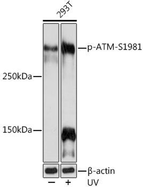 Cell Cycle Antibodies 2 Anti-Phospho-ATM-S1981 Antibody CABP1030