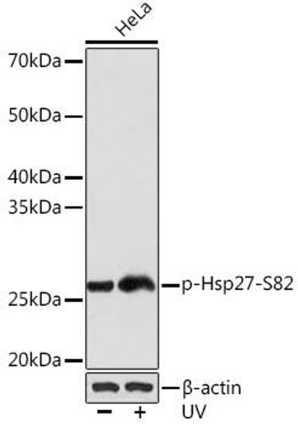 Immunology Antibodies 3 Anti-Phospho-Hsp27-S82 Antibody CABP1031