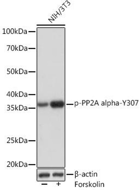 Cell Biology Antibodies 14 Anti-Phospho-PP2A alpha-Y307 Antibody CABP1043