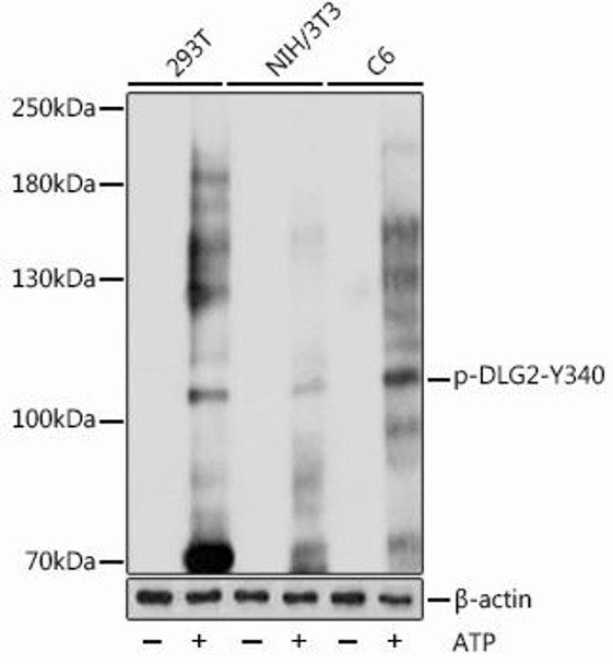 Cell Biology Antibodies 15 Anti-Phospho-DLG2-Y340 Antibody CABP1080