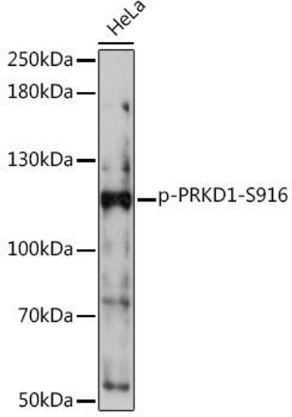 Cardiovascular Antibodies Anti-Phospho-PRKD1-S916 Antibody CABP1097