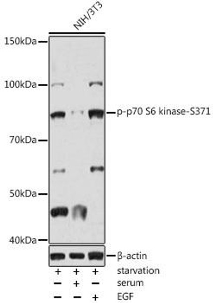 Cell Death Antibodies 2 Anti-Phospho-p70 S6 kinase-S371 Antibody CABP1123