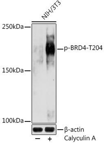 Epigenetics and Nuclear Signaling Antibodies 5 Anti-Phospho-BRD4-T204 Antibody CABP1124