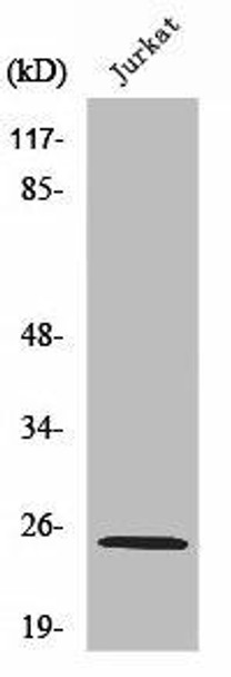 RPL10L Antibody PACO01435