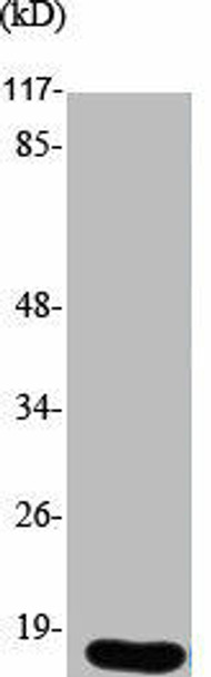 UBE2A/UBE2B Antibody PACO01799