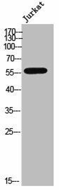 CYP3A4/CYP3A5 Antibody PACO02544