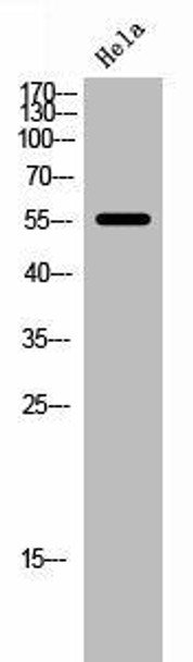 FOXC1/FOXC2 Antibody PACO02739