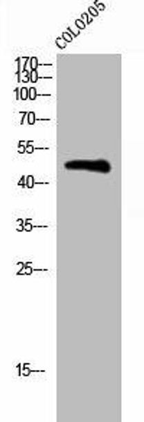 Phospho-BLNK Y96 Antibody PACO02804