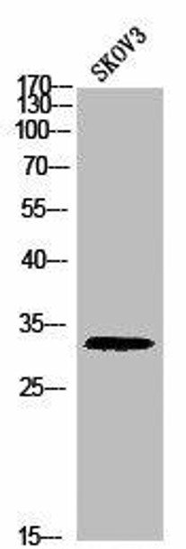 Phospho-Histone H1 T17 Antibody PACO02807