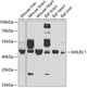 Autophagy Antibodies