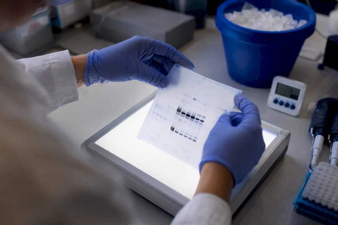 Mains tenant une membrane de western blot éclairée