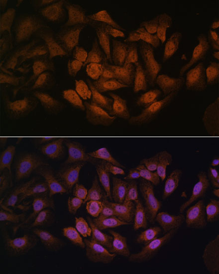 Anti-CNBP Antibody (CAB15110)