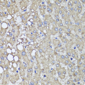 Anti-PIK3C2A Polyclonal Antibody (CAB8526)