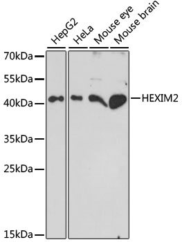 Anti-HEXIM2 Antibody (CAB15565)