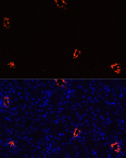 Anti-AQP2 Antibody (CAB16209)