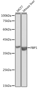 Anti-FBP1 Antibody (CAB5406)