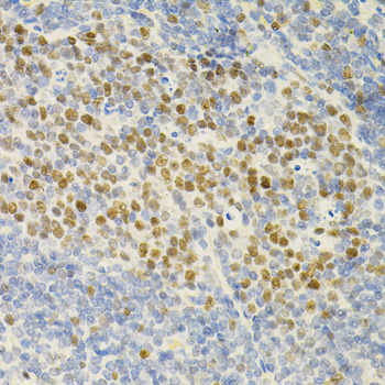 Anti-MCM2 Antibody (CAB0502)