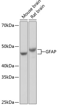 Anti-GFAP Antibody (CAB19058)