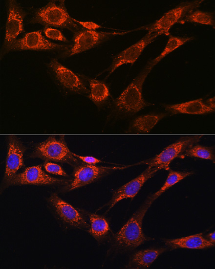 Anti-NCSTN Antibody (CAB0128)