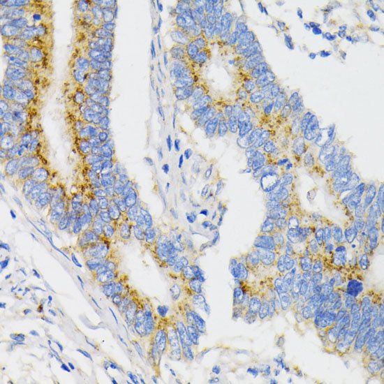 Anti-USO1 Antibody (CAB2796)