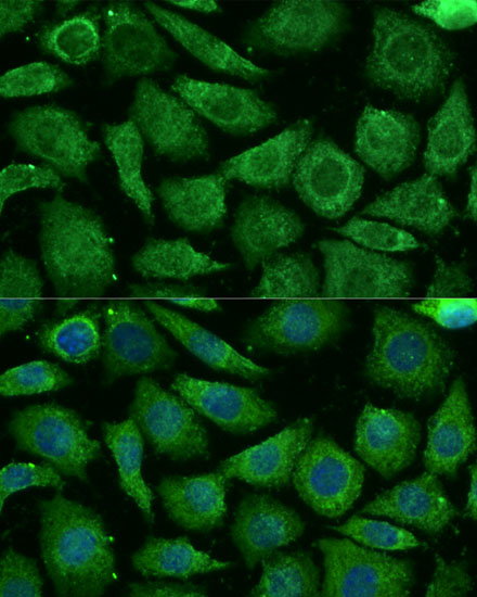 Anti-NDUFB3 Antibody (CAB14378)