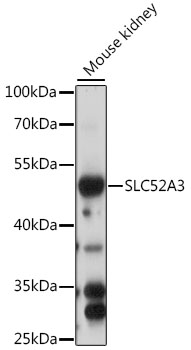 Anti-SLC52A3 Antibody (CAB15935)