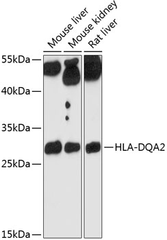 Anti-HLA-DQA2 Polyclonal Antibody (CAB9761)