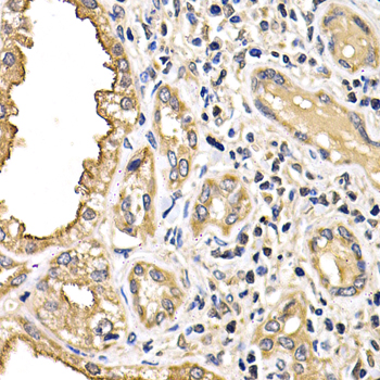 Anti-ARRB2 Antibody (CAB13278)