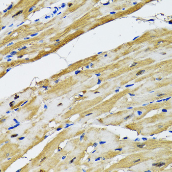 Anti-GOT1 Antibody (CAB5822)