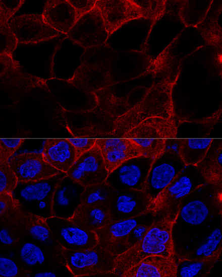 Anti-CD44 Antibody [KO Validated] (CAB12410)