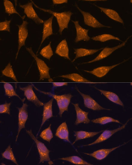 Anti-ACBD3 Antibody (CAB16568)